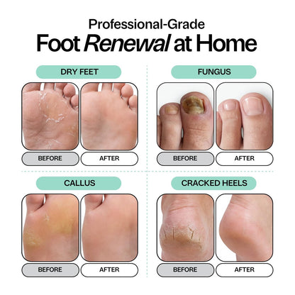 Foot Choice Tea Tree Oil Foot Soak with Epsom Salt - Toenail Repair, Odor Elimination & Callus Softening - Soothes Tired, Sore Feet & Itchy Skin - Made in USA, 16 oz